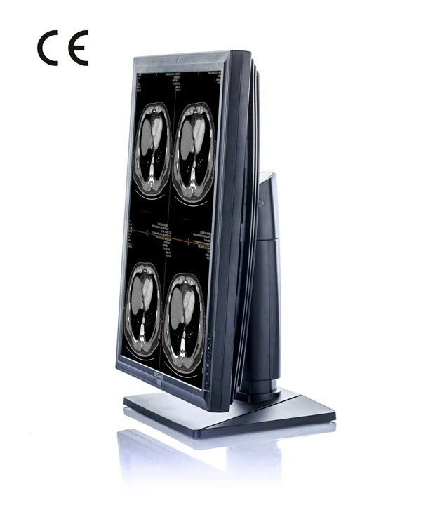 (JUSHA-M23C) 2MP 1600X1200 do Monitor de LED de diagnóstico por raios X e equipamentos médicos de marcação