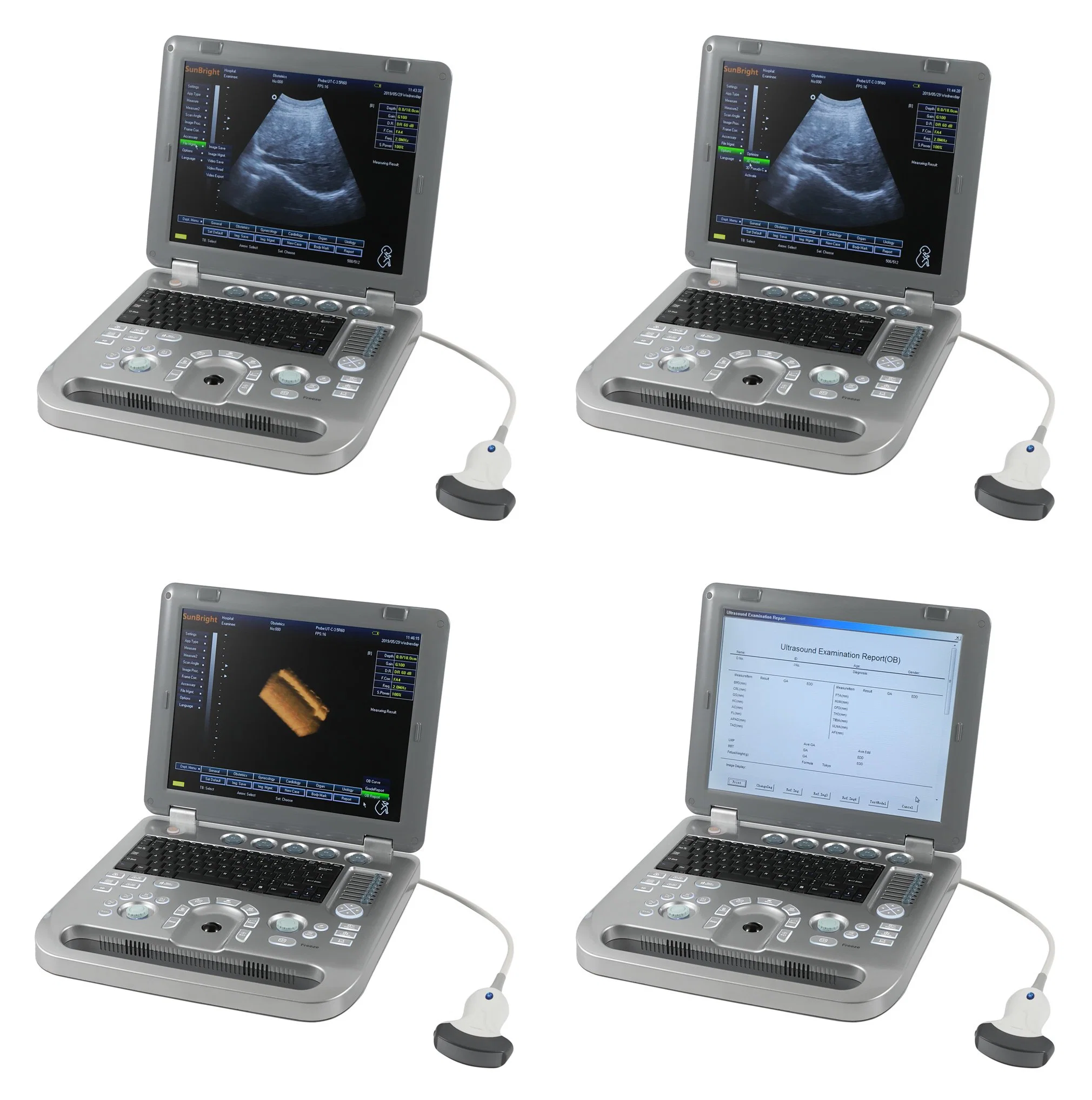 ISO CE-Zulassung Digital Portable 2D 4D Farbdoppler-Echo Ultraschallscanner Der Maschine