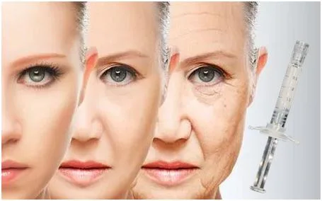 شعار خاص محفز كولاجين بواسطة حقن حمض PCL Hyaluronic Skin Booster