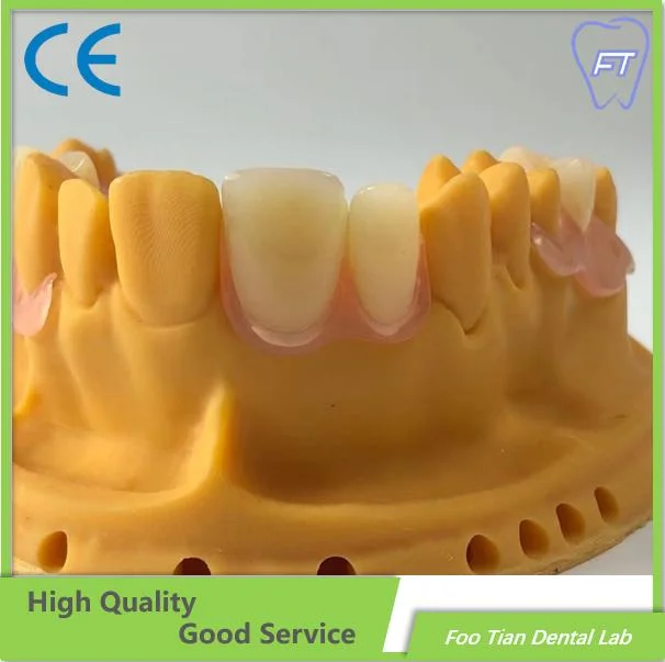 High quality/High cost performance  Removable Denture Cast Partial Framework Dental Customized