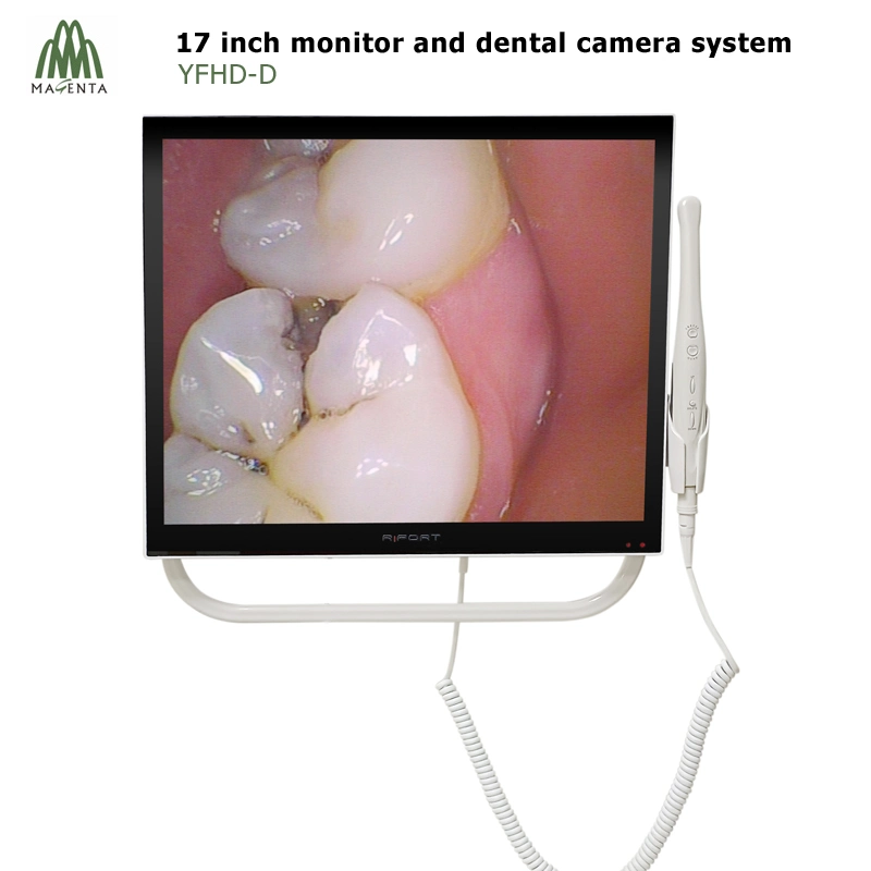 Simple Intraoral Camera and 17 Inch Dental Monitor to Dental Unit