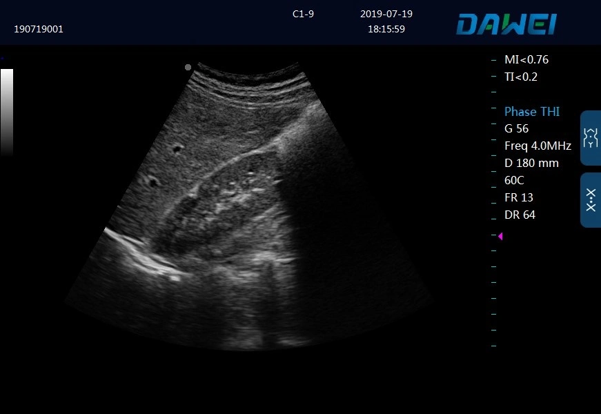 Trolley Black and White Ultrasound Scanner Dw-370 PC