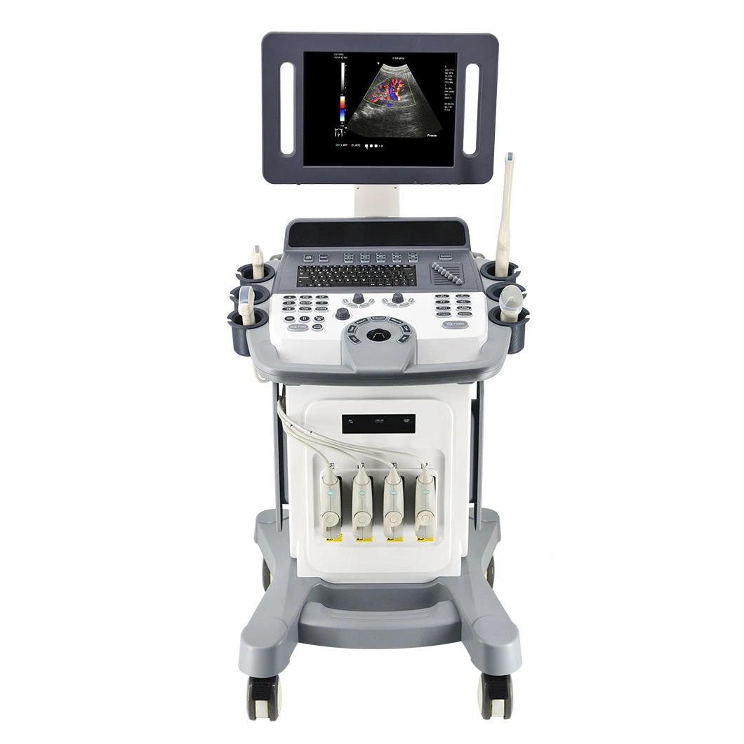 Professional Medical Equipments 3D/4D Trolley Color Doppler Trolley Ultrasound Price