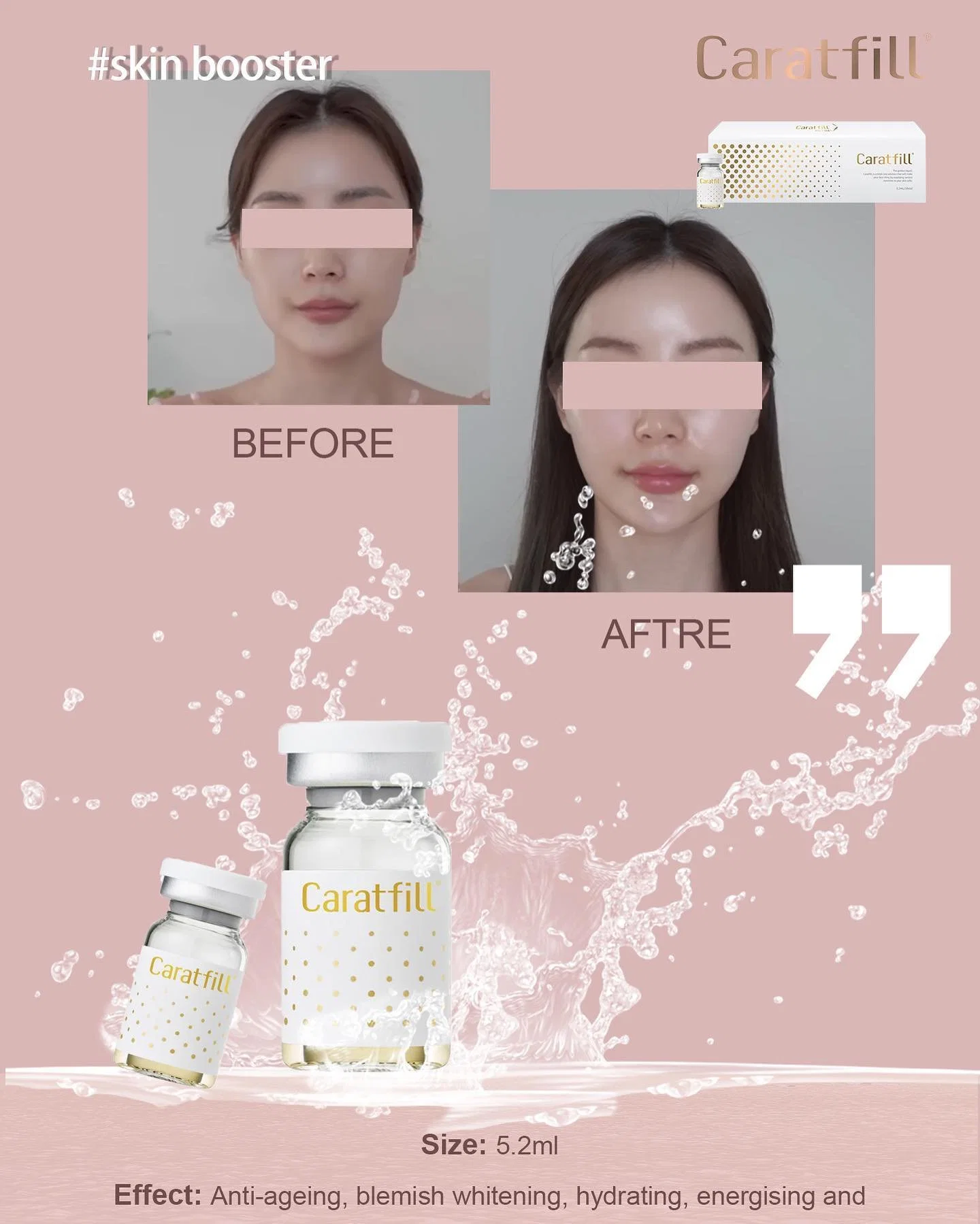 Korean Caratfill Skin Booster Pn + Ha Filler Injection