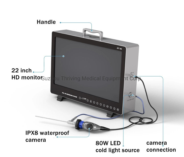 Endoscopio portátil cámara CCD de Monitor de médicos del sistema de cámara de endoscopia