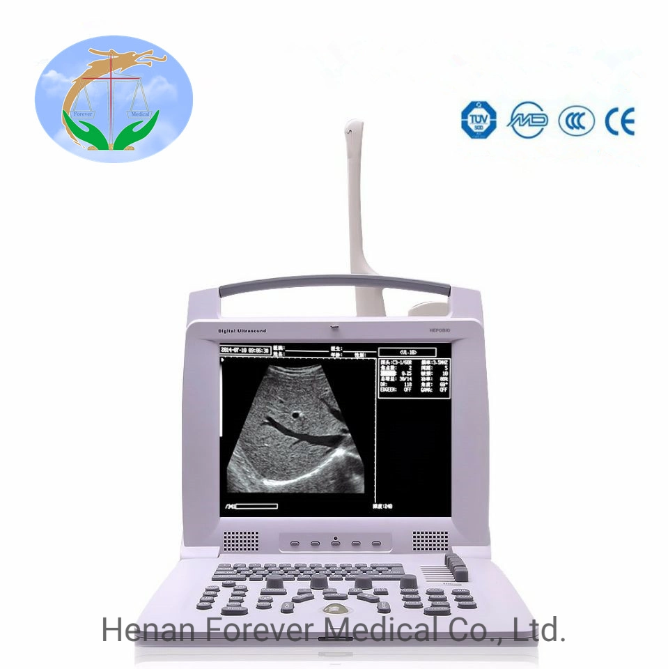 Medical Diagnosis Equipment Portable B/W Ultrasound Scanner with CE ISO