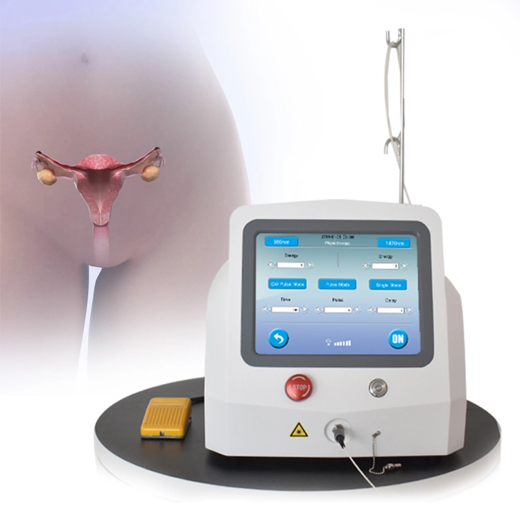 Système laser portable de chirurgie de rajeunissement et de tension vaginal 980nm 1470nm Laser à diode