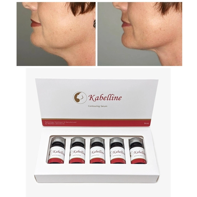 Kybella Allergan Belkyra Fat Dissolver Results Swelling for Double Chin Reduction Nom-Surgical Neck Fat Loss Weight Injection Kabelline Lemonbottle Ozempics