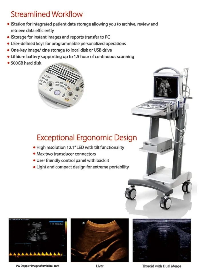 Mindray DP-30 4D Ultrasound portátil Doppler escáner de ultrasonidos