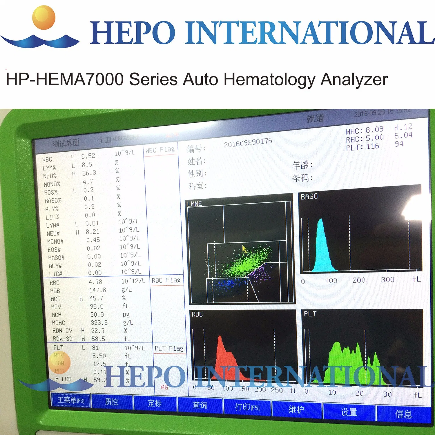 32 Parámetros totalmente automático 5parte médico Hematología Analyzer de dif.