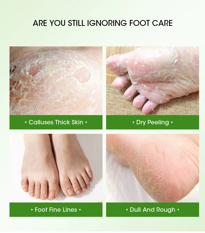 Natural Herbal Foot Skin Care Moisturizing Exfoliating Peeling off Foot Mask