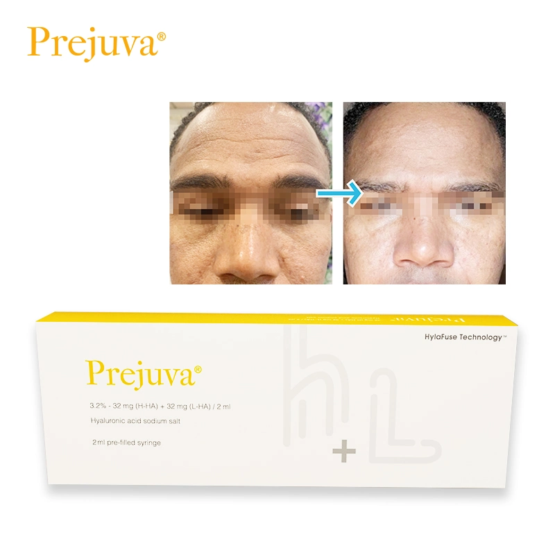 Prejuva 2ml mejore el cuidado de la piel Anti-Aging Prohilo Anti-arrugas cara de suero Elevación del relleno dermal H L