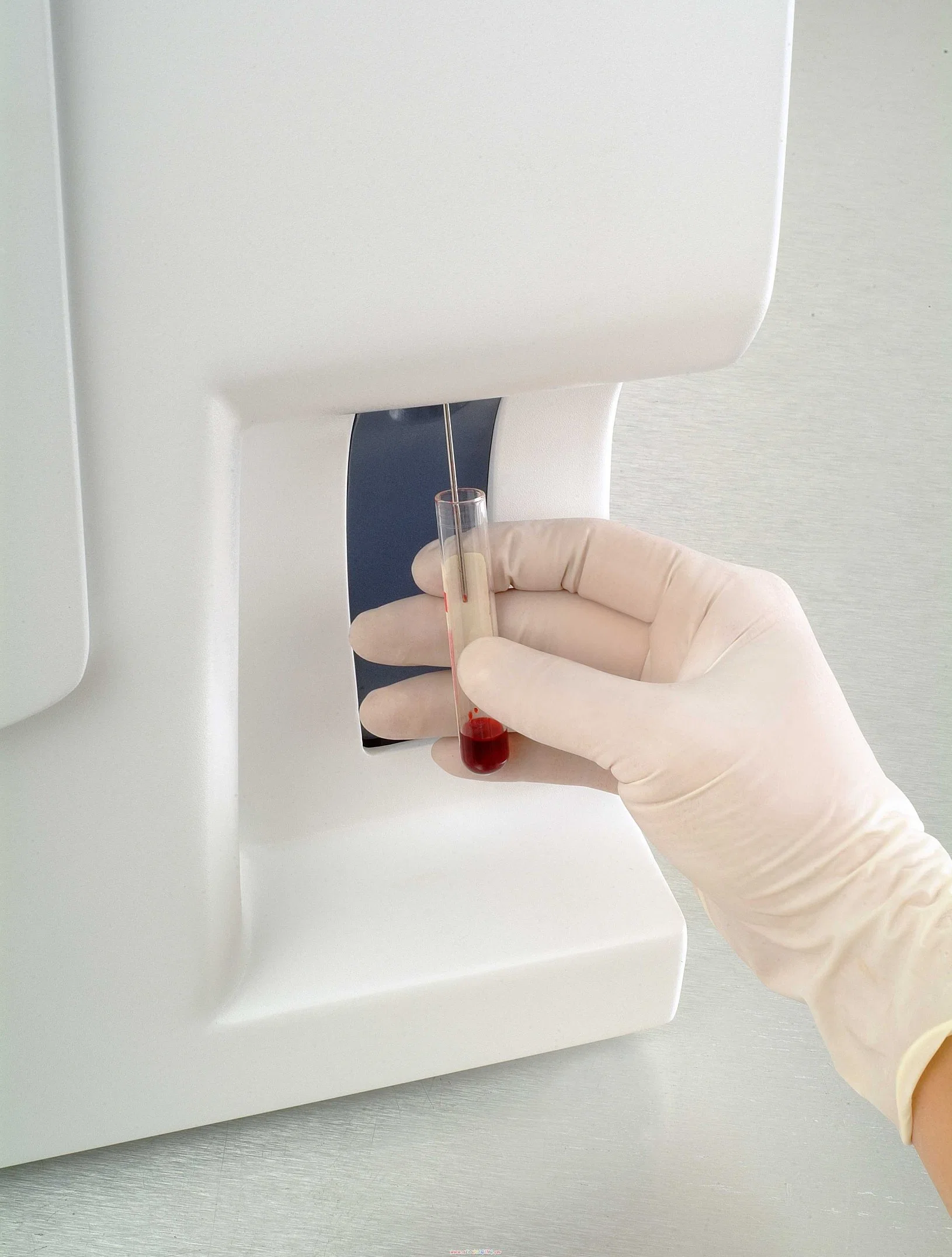 Analisador de hematologia automático portátil para laboratório de testes sanguíneos