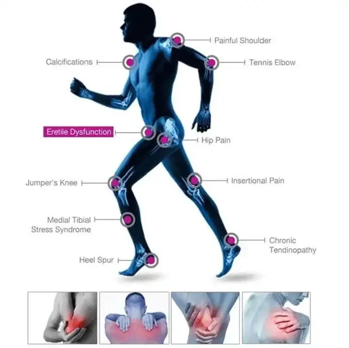 Hot Selling 10 Bar Focused Extracorporeal Shockwave Therapy Machine for ED Treatment Pneumatic Physical Therapy Device