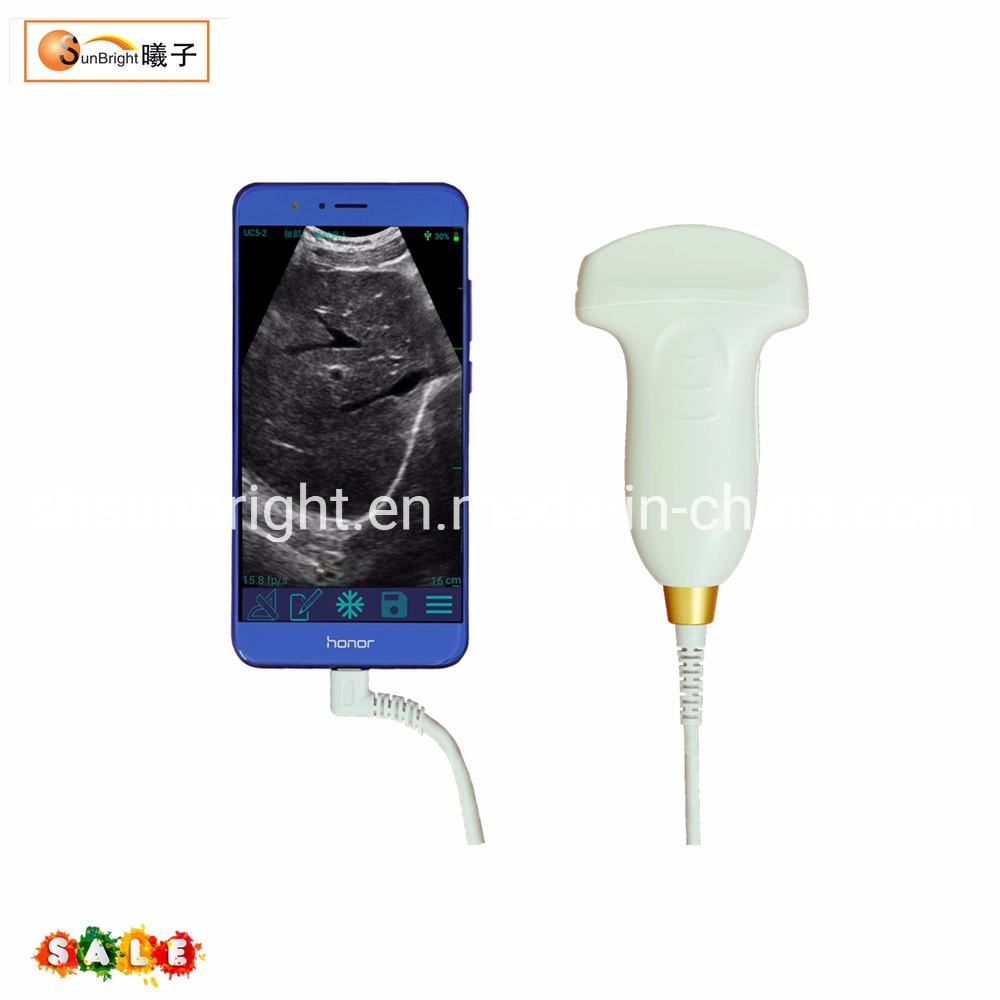 Digital Hand Held USB Convex Probe Ultrasound Sun-P1