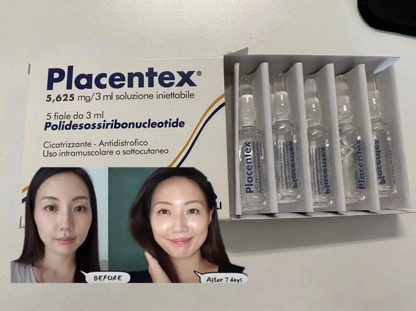 Placentex Filler Mastelli (Pdrn) for Skin Booster