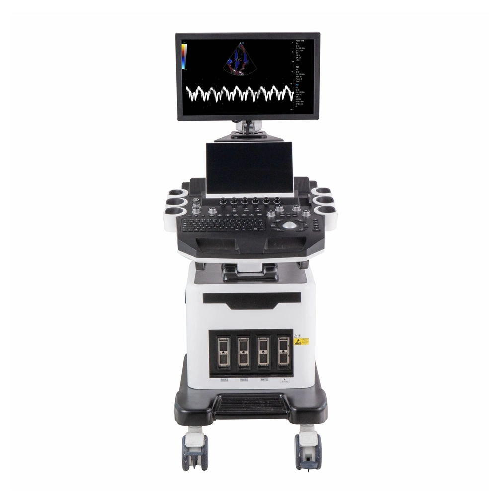 Hospital Equipment High End 4D/5D Mobile Trolley Color Doppler Ultrasound Machine for Ob&Gyn