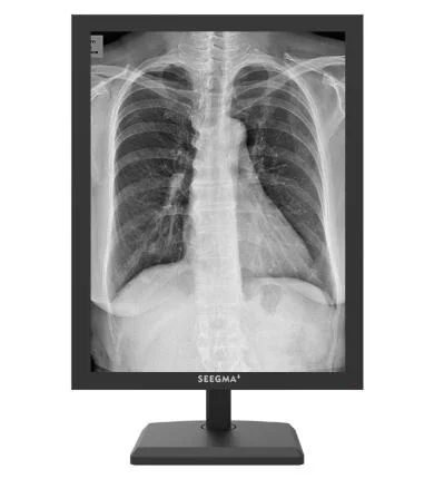 Top Quality Diagnostic 3MP Grayscale Medical Monitor with 3c