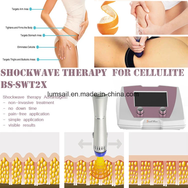 Best Sell Acoustic Wave Therapy Equipment for Cellulite