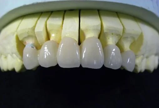 Translúcido alta Cad Cam Zircónia Dental blocos de cerâmica