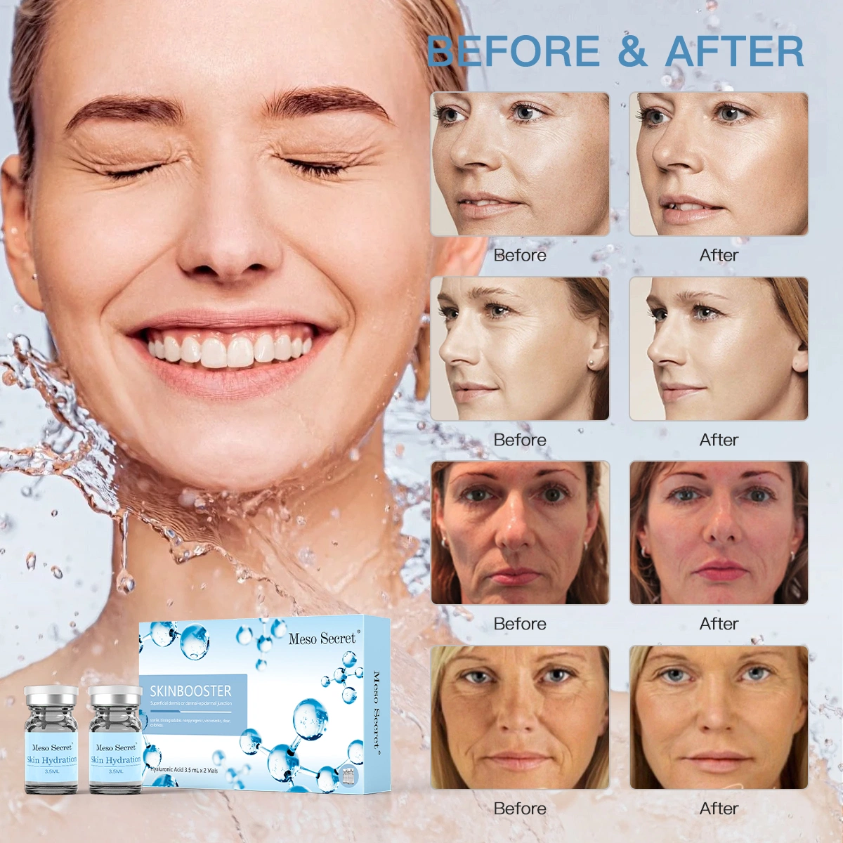 Anti-Wrinkle Youthful Skin Treatment Injectable Hyaluronic Acid