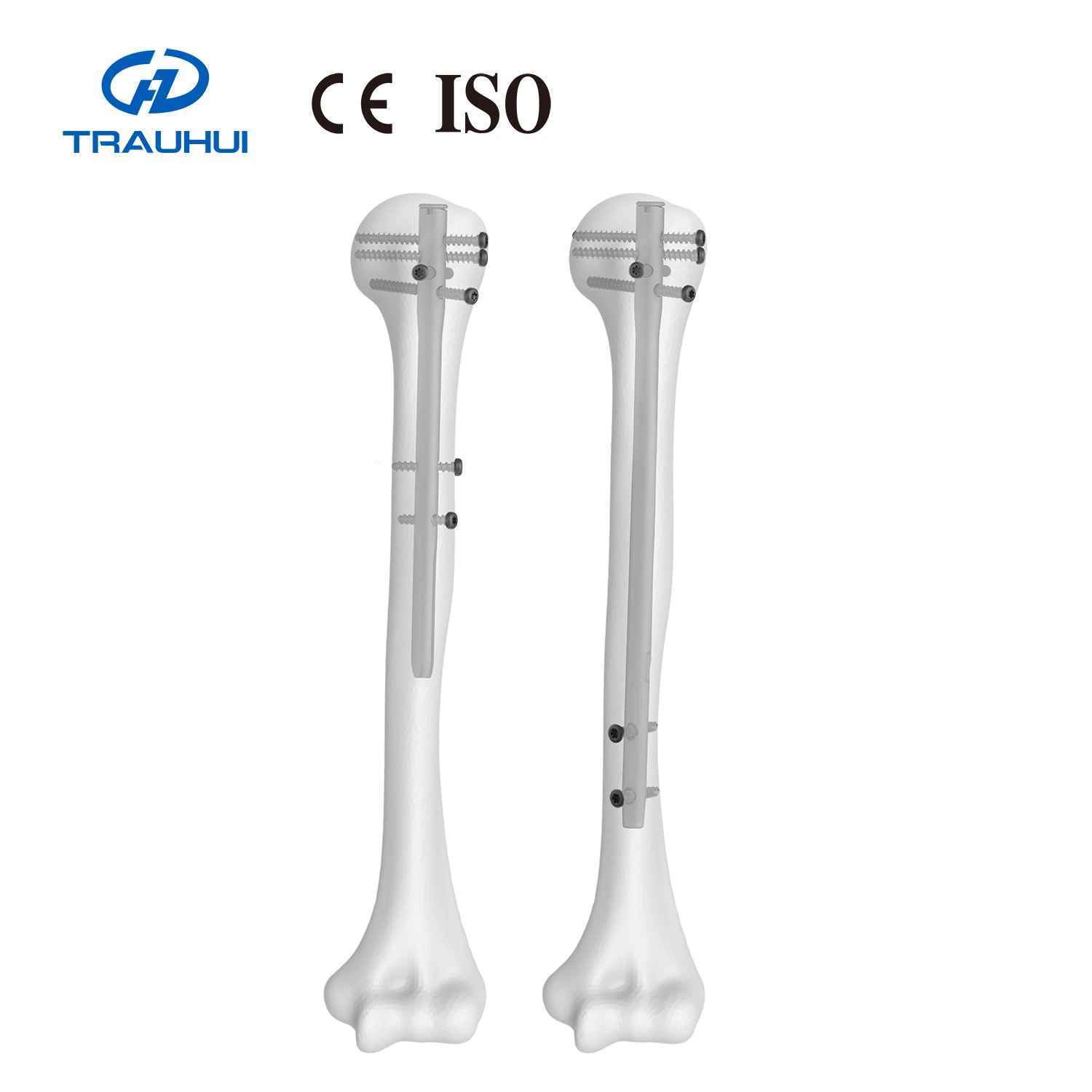 Humeral Nail Straight Design Orthopedic Instrument