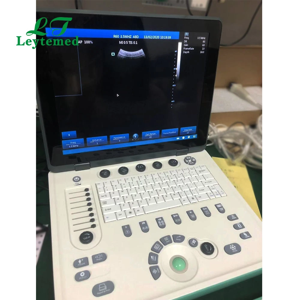 Ltub19 Cheap Portable 15 Inch Laptop Ultrasound Scanner Medical Used for Human