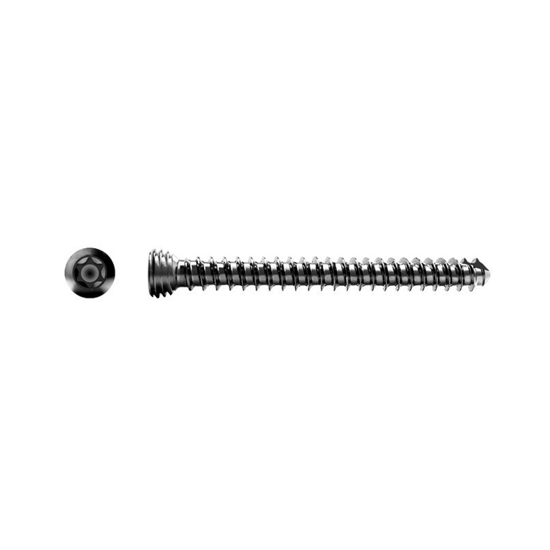 &Fcy; 2.0mm Cortex/Cortical Screw Orthopedic Implants Products Bone Screws