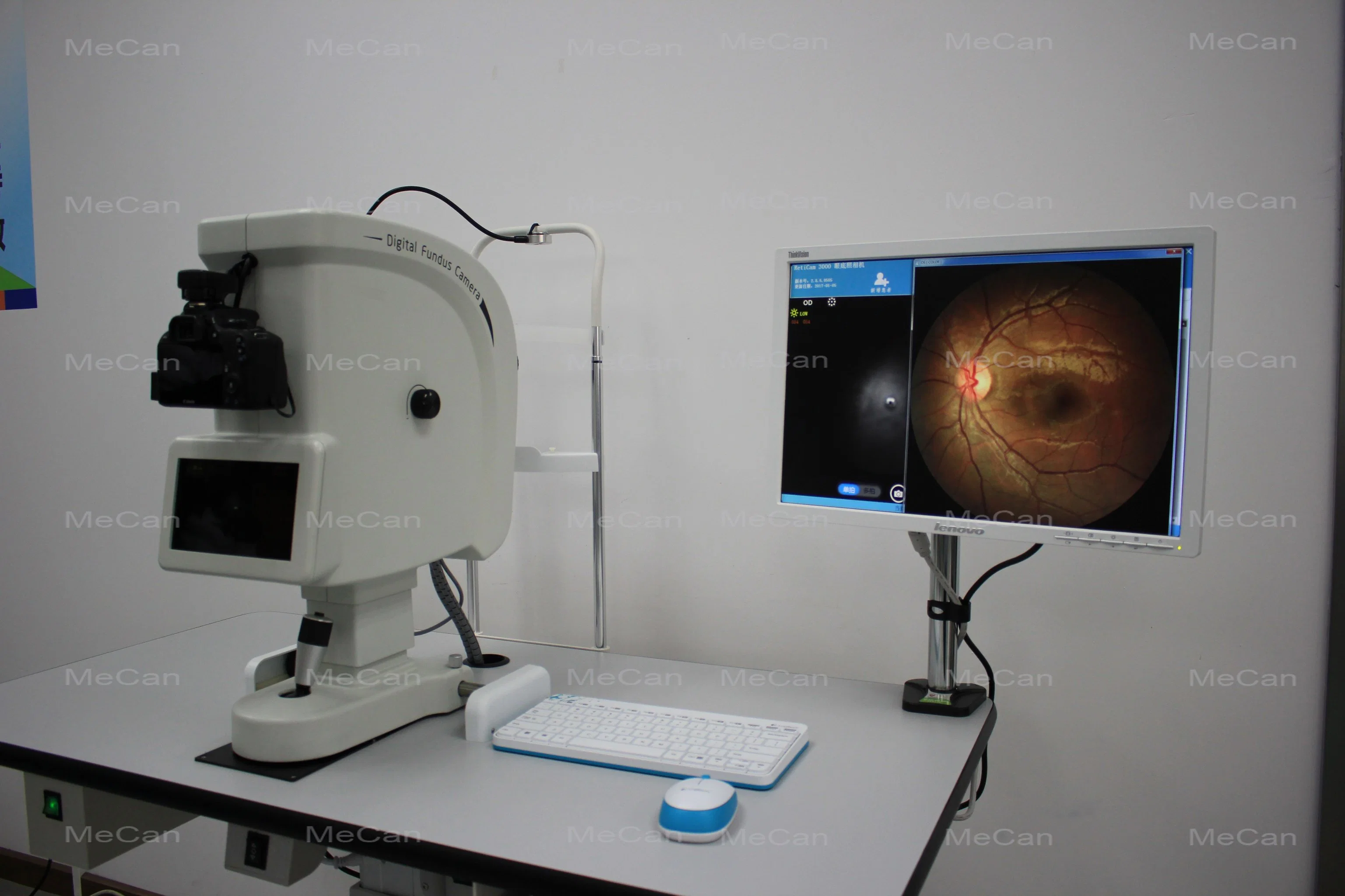 Ophthalmic Equipment Auto Digital Eye Retinal Ophthalmic Fundus Camera
