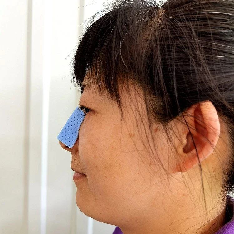 Direct Source Blue Color Nose Splint for Plastic Surgery Rhinoplasty