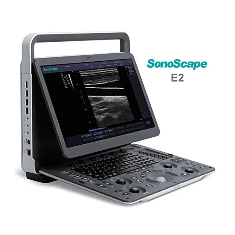 Sonoscape E2 Portable Doppler Ultrasound Machine for Medical