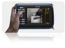 Scanner de ultrassons portátil para diagnóstico médico