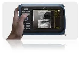 Scanner portable de diagnostic médical à ultrasons