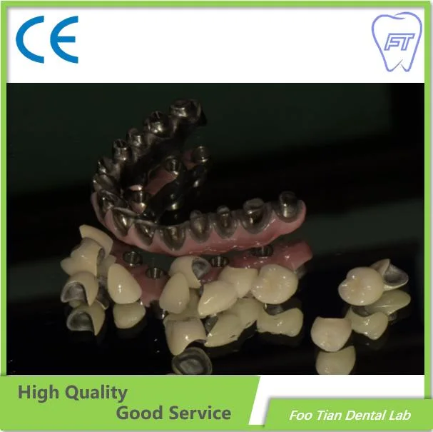 Bon produit et de la Couronne de zircone pont fait de la Chine Dental Lab