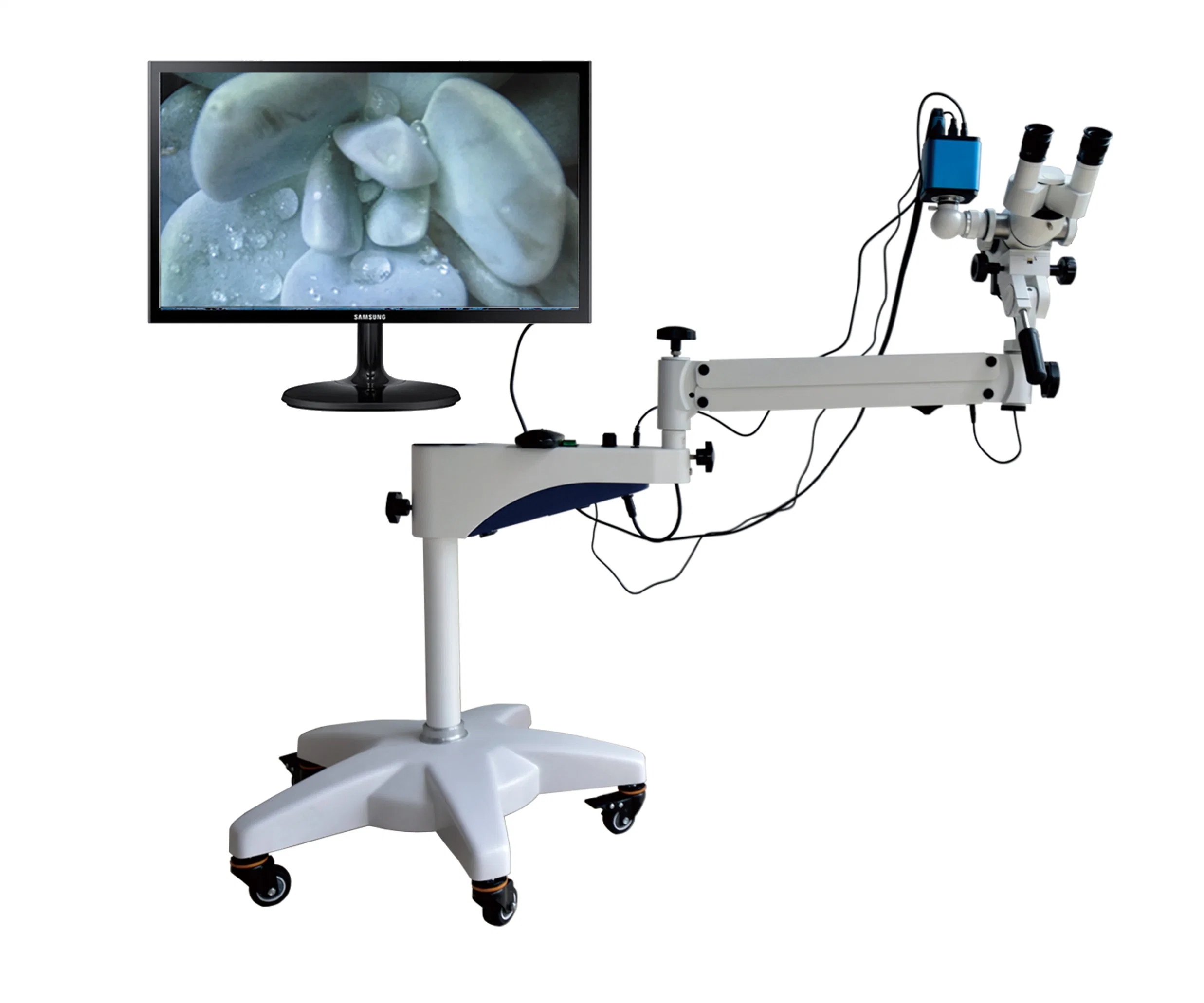 Optical Colposcope for Medical Vaginal Exam