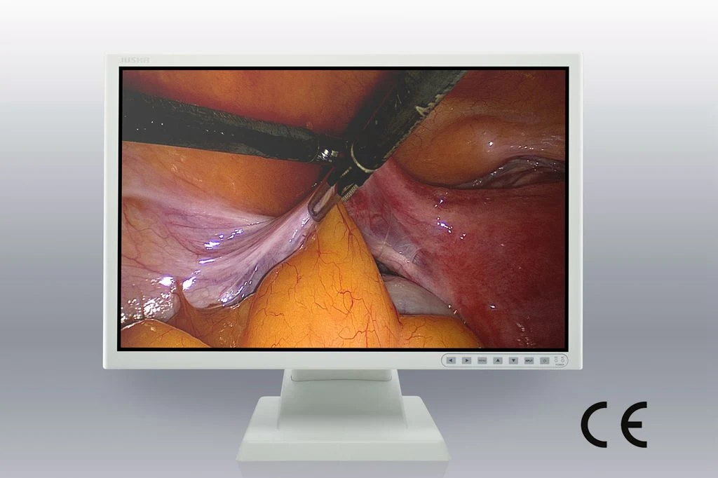 24-Inch 1920X1200 LCD Screen Ce Approved Endoscopy Monitor