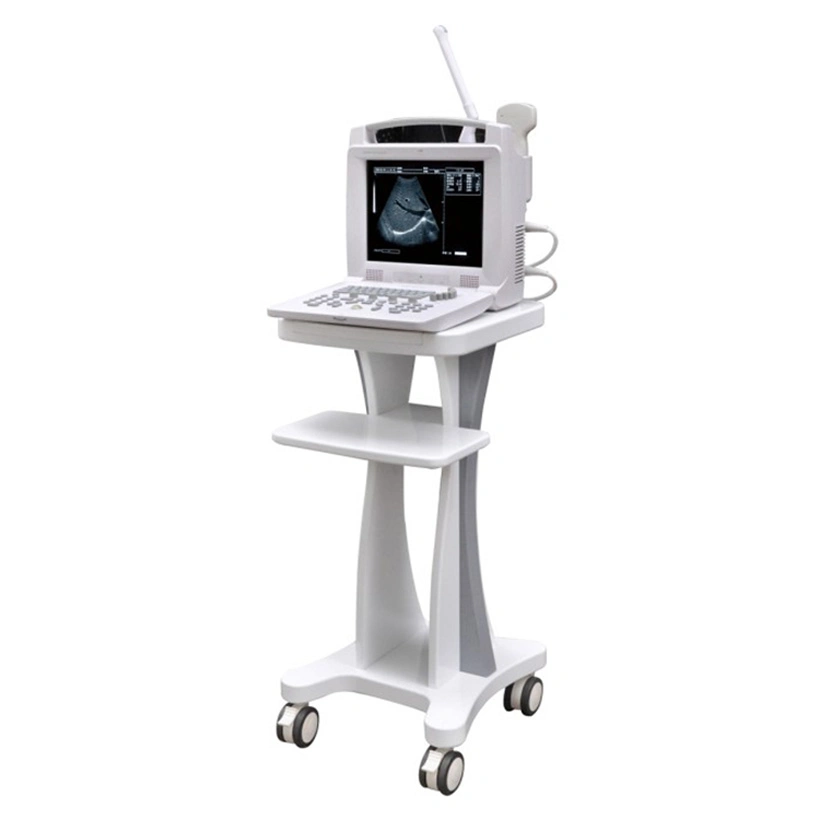 Portable Screen Ultrasound Instruments Machine Scanner Digital Mindray Ultrasouns Price Doppler Obstetrics Ultrasound Machines