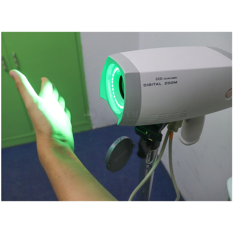 Sy-F005 LED Cold Light System CCD Camera Handheld Video Colposcope Price