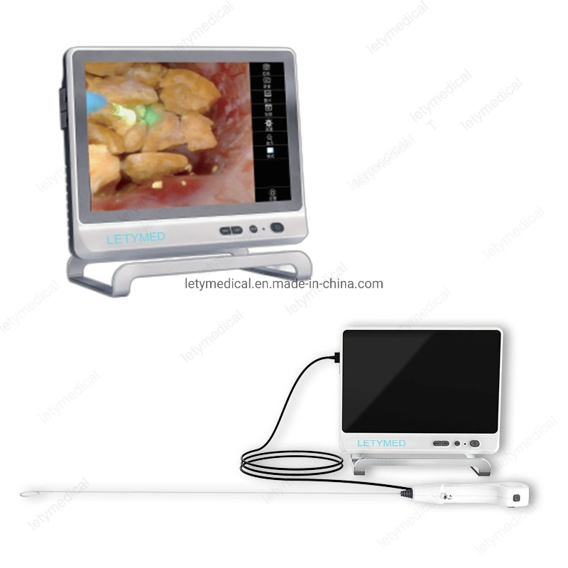 High quality/High cost performance  Urology Single-Use Flexible Video Ureteroscope Digital Disposable Urethroscope Endoscope Uretero-Renoscope