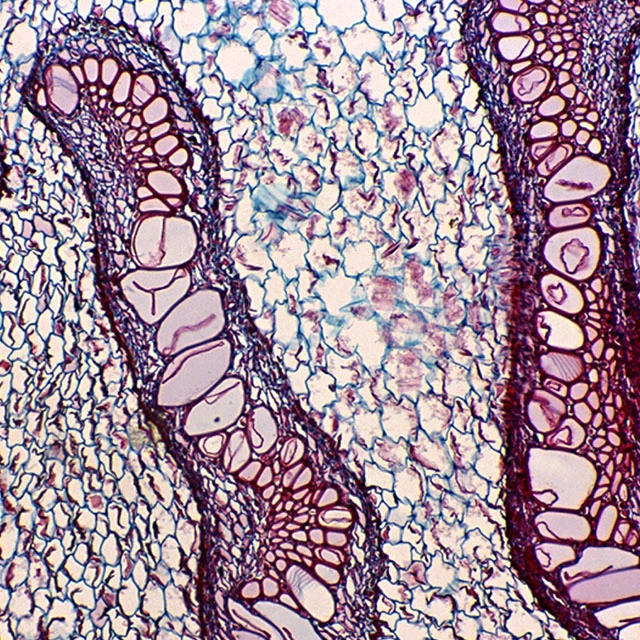 BestScope BS-2046T LED NA1,25 Investigación médica microscopio biológico trinocular