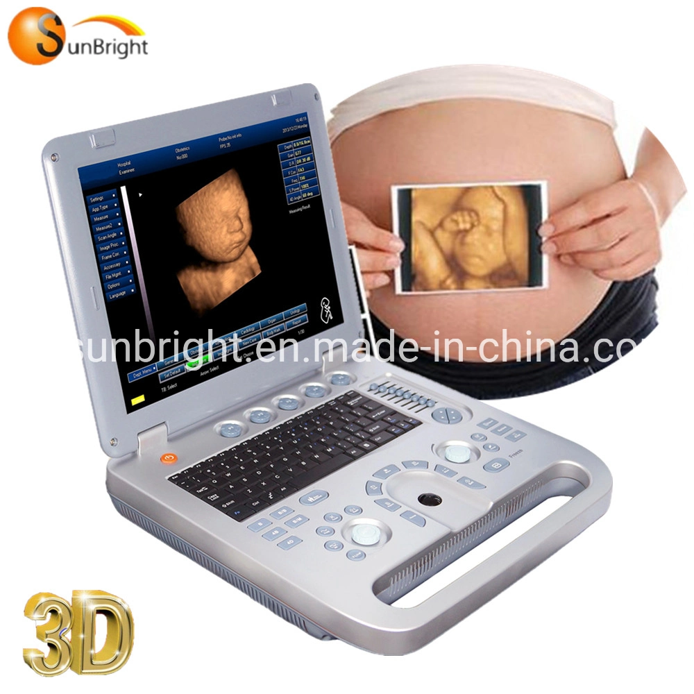 Sun-800d Excellent Image Quality Laptop 3D Ultrasound B Mode Scanner