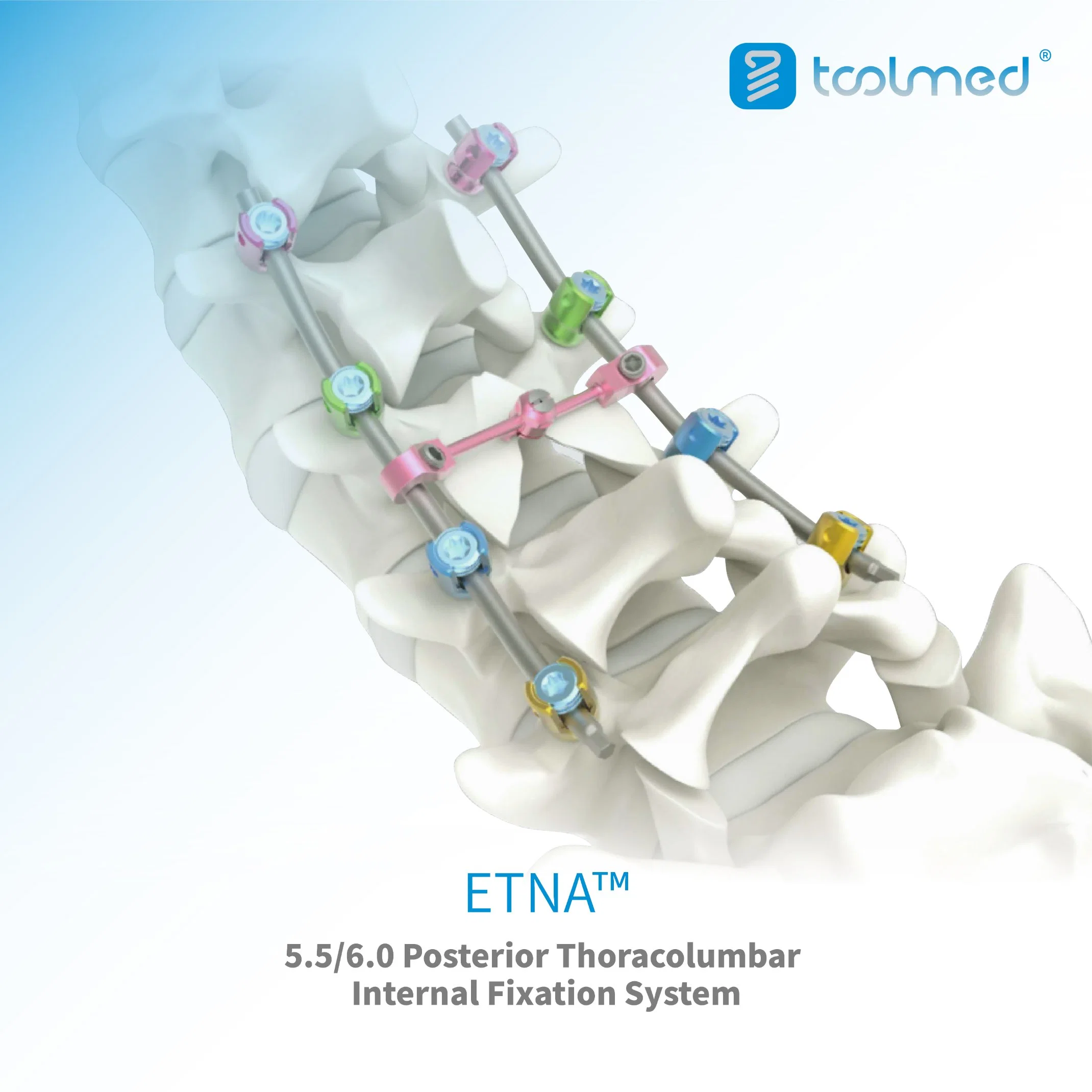 Einaxiale Pedikel Schraube, Etna™ 5,5 posteriores Thoracolumbar Spinalsystem, Titan Orthopädische Chirurgie Implantat für Wirbelsäulenchirurgie, Medizinprodukte CE&amp;ISO