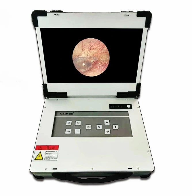Medical Integrated Endoscopy with Full HD Endoscopic Camera System