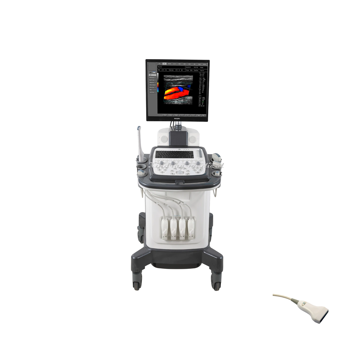 for Medical Image Enhancement Trolley Ultrasound Machine