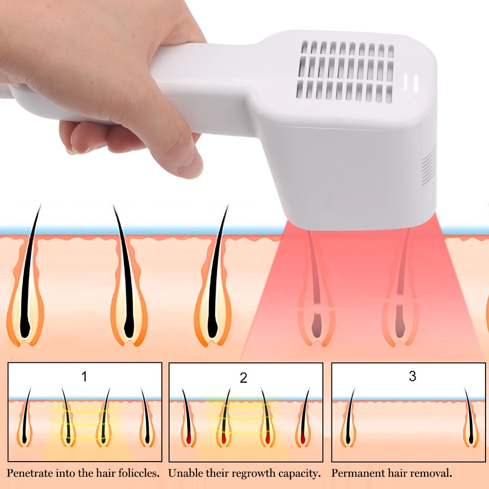 منزل صغير استخدم تقنية IPL لإزالة الشعر آلة الليزر الجمال المحمول شعر مُجدَّد للرجال والنساء