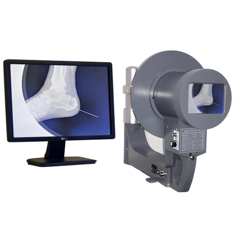 Juzheng Xr-100c-1 Portable X-ray Fluoroscopy Instrument for Veterinary and Pet Clinic