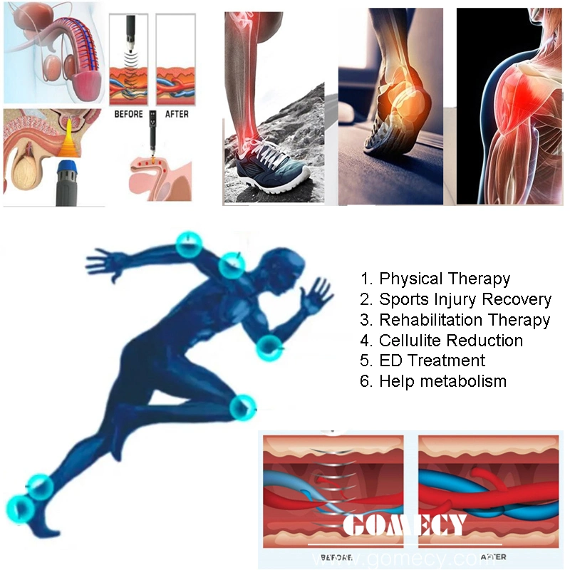 Medical Equipment Extracorporeal Shock Wave Pain Therapy Systems for ED Treatment Cellulite Reduction