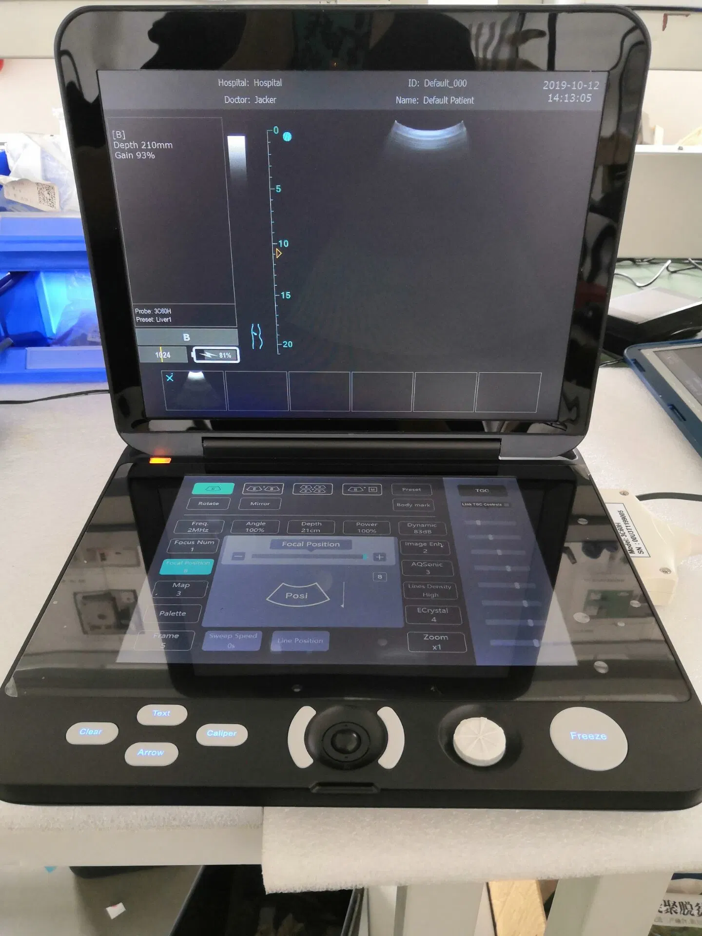 Medizinische Diagnosegereichte Laptop Farbdoppler Ultraschallscanner