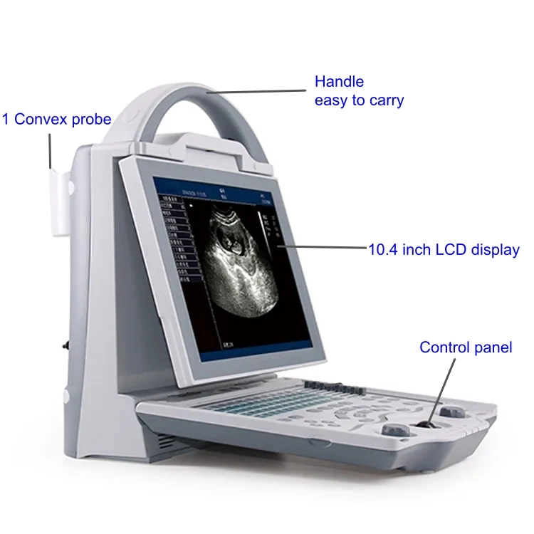 Venta caliente el diagnóstico médico el equipo B/W máquina de ultrasonido ecógrafo portátil (THR-YS5600)