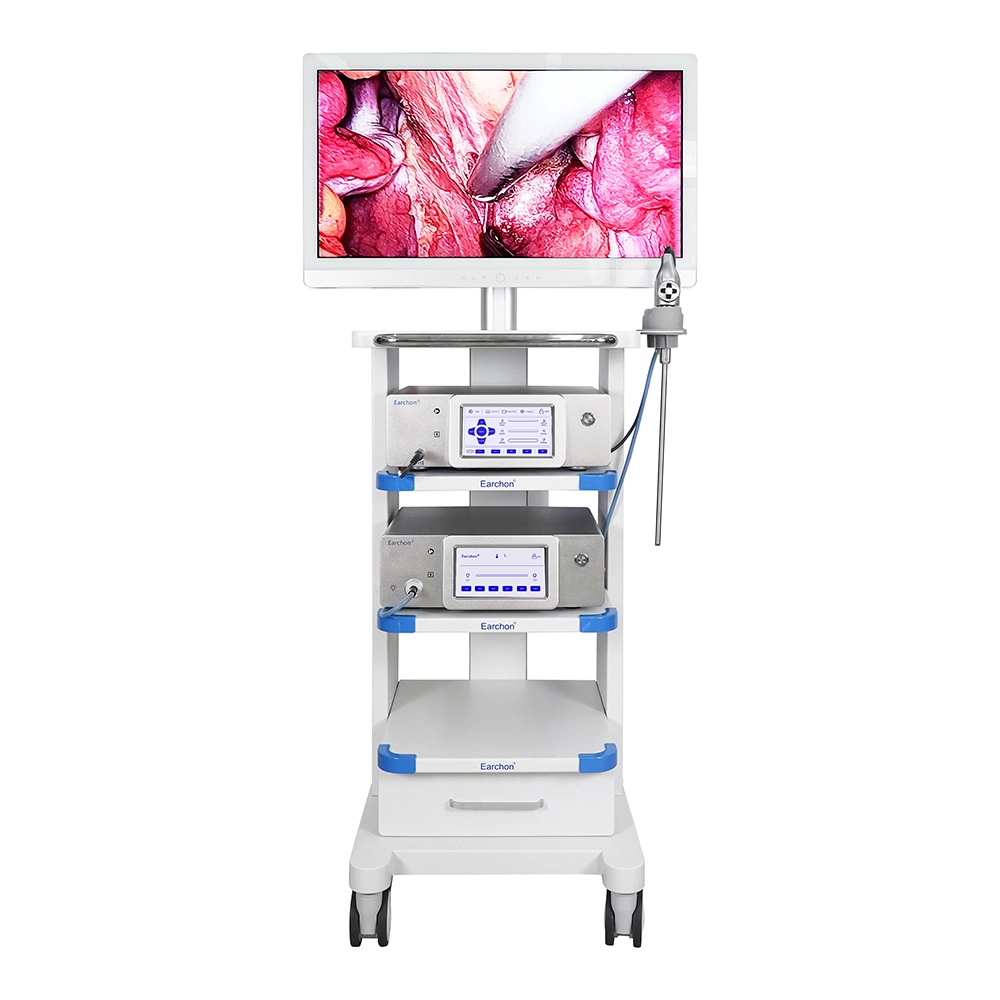 1080P HD Endoscope Camera System Medical Imaging Instrument